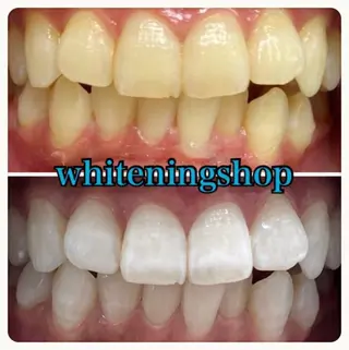 ホワイトニング ショップ吉祥寺店のエステ・リラクイメージ