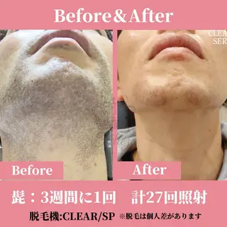 メンズ 有人型セルフサロン 脱毛/痩身/美顔のエステ・リラクイメージ