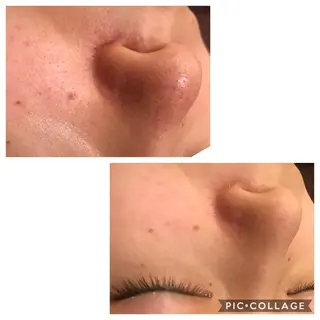 ショート カラー パーマ ヘアアレンジ メンズ キッズ ネイル マツエク・マツパ 四つ星サロン🎖 腸＆ニキビケアに特化のエステ・リラクイメージ