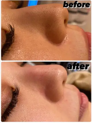 ハーブピーリング専門 muro.のエステ・リラクイメージ