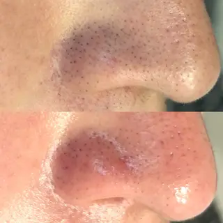 アイラッシュサロン CoCoのマツエク・マツパデザイン