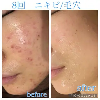 ロング カラー パーマ ヘアアレンジ メンズ ネイル マツエク・マツパ Ensor Clair所属・EnsorClair 代表　野口真央のエステ・リラクイメージ