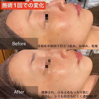 ビューティースリム reborn 新宿店のエステ・リラクイメージ