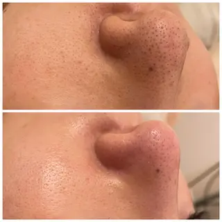 ララ/ハーブ メゾンリュバンのエステ・リラクイメージ