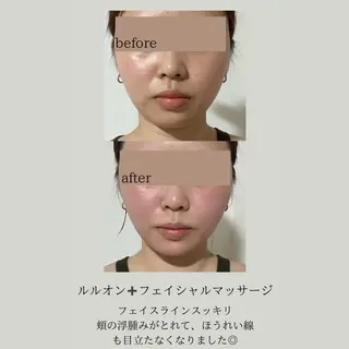 yosapark koiのエステ・リラクイメージ