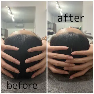 Body care salon LUANA所属・LUANA/小顔整体 men's脱毛のその他イメージ