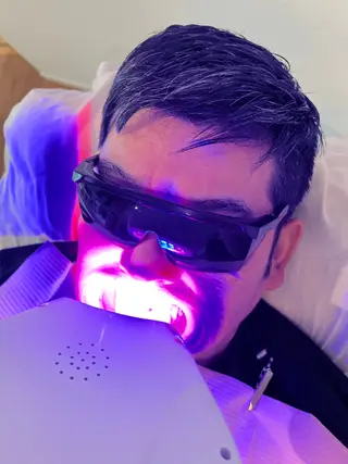 セルフホワイトニング Shineeのエステ・リラクイメージ