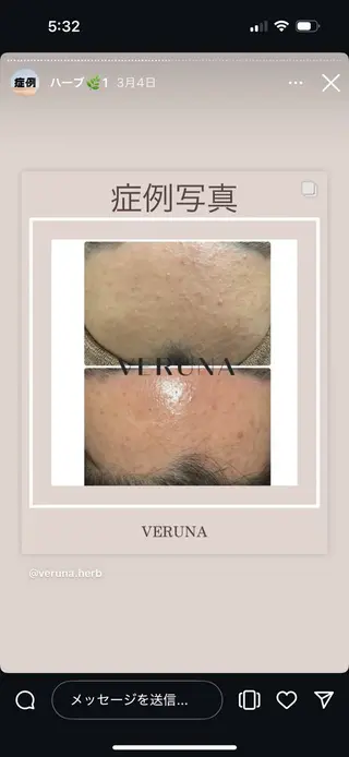 Grandir所属・ハーブピーリング専門 グランディール　武内のエステ・リラクイメージ