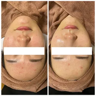 Linoa所属・Linoa（リノア） エステ&リラクのエステ・リラクイメージ