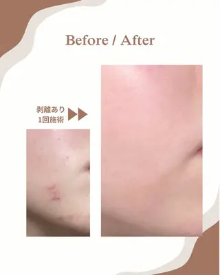 myherb所属・ニキビ肌改善サロン myherb🌿のエステ・リラクイメージ