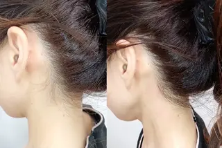 美肌専門サロン RUBONのエステ・リラクイメージ