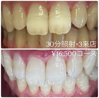 PLATINUM Beauty 横浜店所属・ホワイトニングルーム 横浜店のその他イメージ