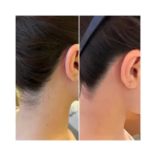 ミディアム ヘアアレンジ アイブロウ ワックス脱毛🌈 ESPOIRnocoのエステ・リラクイメージ