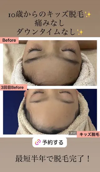 キッズ ブライダル痩身×脱毛 尼崎駅前サロンのエステ・リラクイメージ