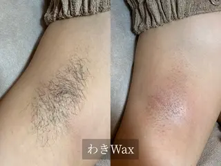 プライベート脱毛サロン　Arum所属・脱毛サロン Arumのエステ・リラクイメージ