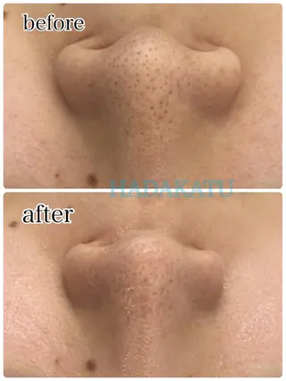 総合エステサロン 肌活のエステ・リラクイメージ