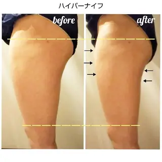 【ニキビ/肌管理】 salon varyのエステ・リラクイメージ