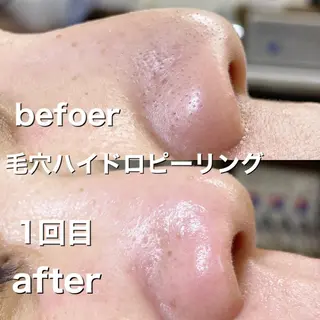 エステサロンmagnolia所属・小野 優子の眉毛・アイブロウイメージ