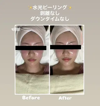 脱毛サロン エクボスタッフのエステ・リラクイメージ