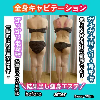 痩身/脱毛/ネイル HARUKAのエステ・リラクイメージ