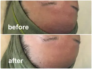 ブライダルエステ専門 入谷友莉のエステ・リラクイメージ