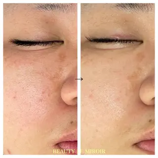 ビューティー ミロワールのエステ・リラクイメージ