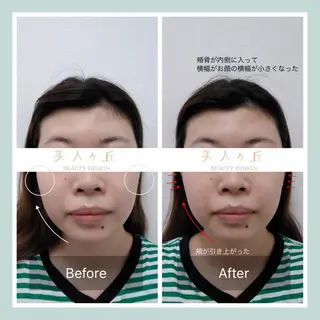 韓国/ヌーディー系 ネイル自由が丘のネイルデザイン