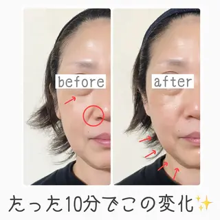 mooi【モーイ】所属・【北堀江】 痩身/小顔　mooiのエステ・リラクイメージ