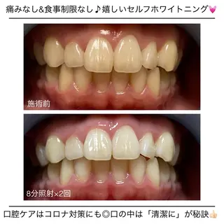 ネイル ネイル/耳つぼ /新ホワイトニングのネイルデザイン