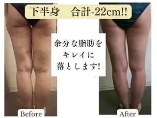 【目黒】本格痩身✴︎ 最新型よもぎ蒸しのエステ・リラクイメージ