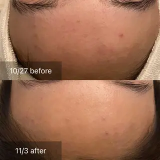 hm NATURESKINのエステ・リラクイメージ