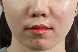 看護師が施術する美容 ナスサロ｜noaのエステ・リラクイメージ