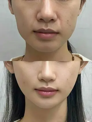 マツエク・マツパ aliaハイフ&水光ジェットサロン所属・aliaハーブ水光店 エステティシャン募集のエステ・リラクイメージ