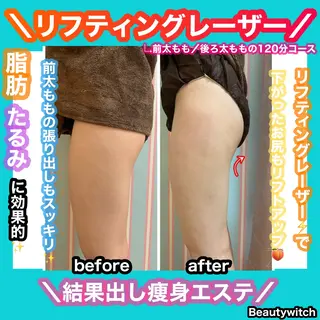 痩身/脱毛/ネイル HARUKAのエステ・リラクイメージ