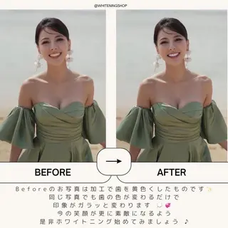 メンズ ホワイトニング ショップ本八幡店のエステ・リラクイメージ