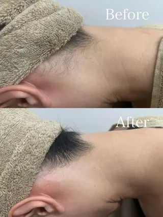 VIO /美肌専門サロン【Beauty  salon Bibiy】所属・VIO美肌専門サロン Bibiyのエステ・リラクイメージ