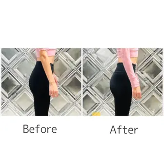 小顔モニター 募集のエステ・リラクイメージ