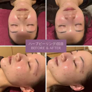 Re:be（リーベ）所属・Re:be 香奈のエステ・リラクイメージ