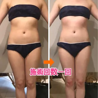 ロング カラー パーマ ヘアアレンジ メンズ キッズ ネイル マツエク・マツパ ‍痩身＆ボディ 結果出し🌟丹野のエステ・リラクイメージ