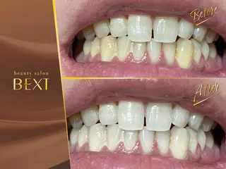 ビューティーサロンベクスト beautysalonBEXT所属・ビューティーサロン ベクスト名古屋のエステ・リラクイメージ