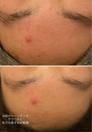 美時雨・bishigure所属・美時雨 bishigureのエステ・リラクイメージ