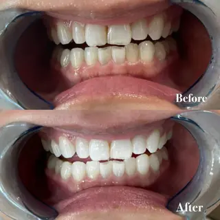 ライトビューティー 銀座店のエステ・リラクイメージ