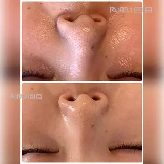 堀井 舞琳のエステ・リラクイメージ