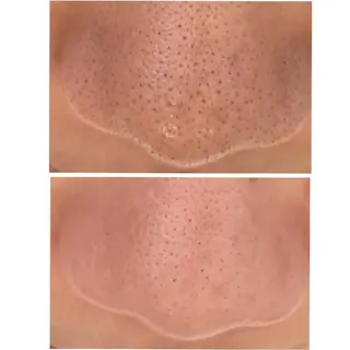 整体エステ　NEW ME所属・深層リンパオイル/小 顔とドライヘッドスパのエステ・リラクイメージ