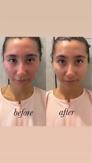 鍼灸サロン mahorobaトモのエステ・リラクイメージ