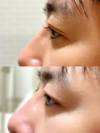 マツエク・マツパ 中村 眞子のマツエク・マツパデザイン