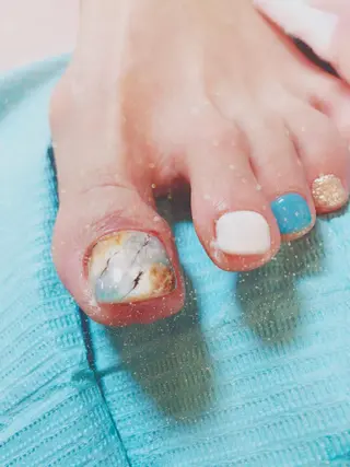 ネイル 山中 あいのネイルデザイン