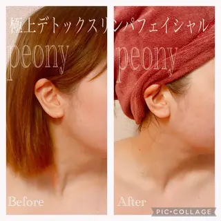 デトックス美容専門サロンｐｅｏｎｙ所属・デトックス美容専門 サロンｐｅｏｎｙのエステ・リラクイメージ