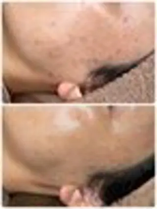 メンズ 【BUB立川】 ゆかのエステ・リラクイメージ