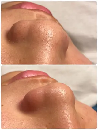 キッズ salon Sunny所属・脱毛salon Sunnyのエステ・リラクイメージ